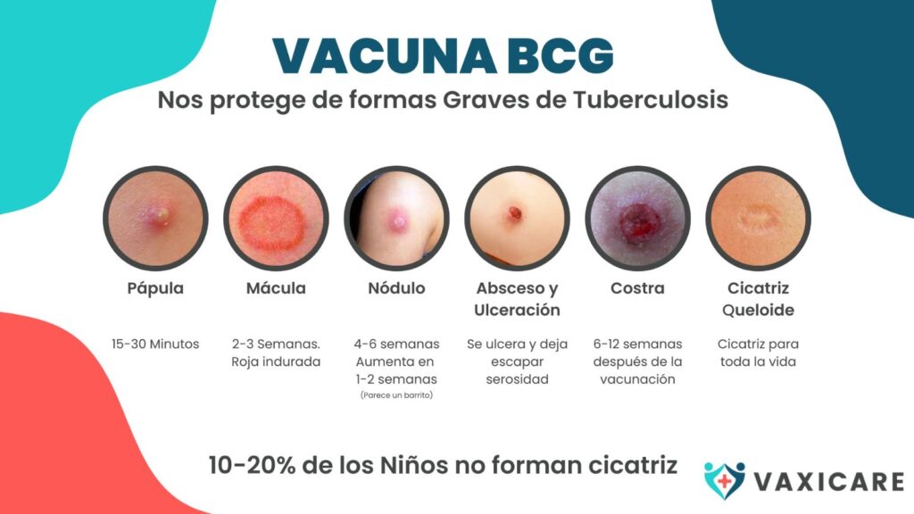 Evolución de la vacuna BCG